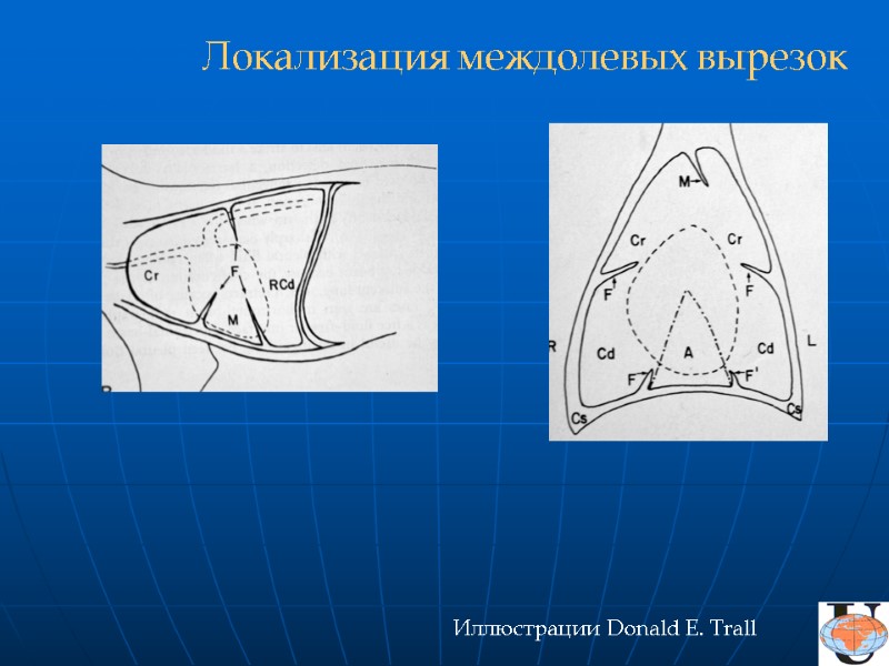 Иллюстрации Donald E. Trall Локализация междолевых вырезок